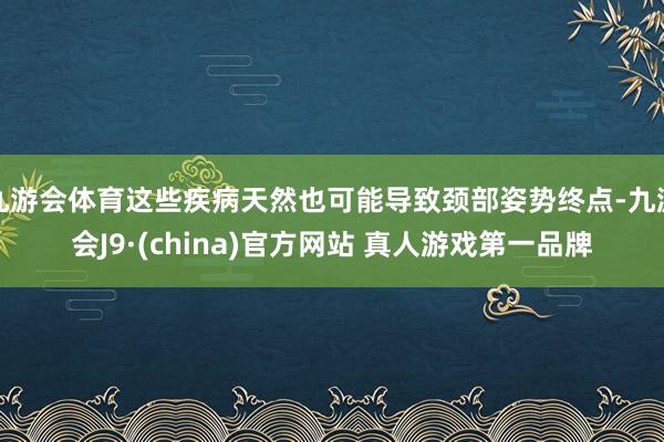 九游会体育这些疾病天然也可能导致颈部姿势终点-九游会J9·(china)官方网站 真人游戏第一品牌